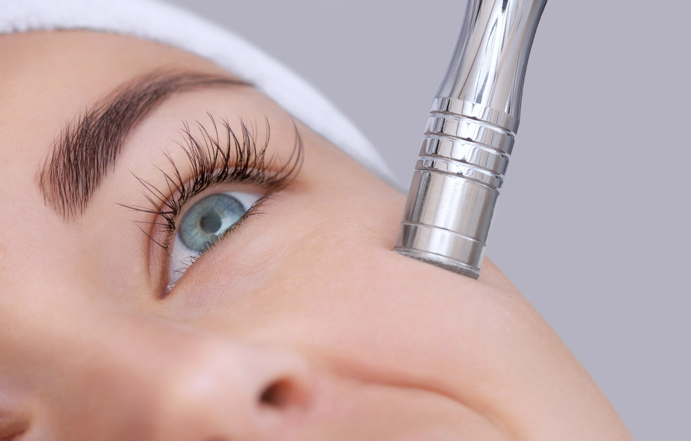Can Microdermabrasion Reduce Wrinkles?